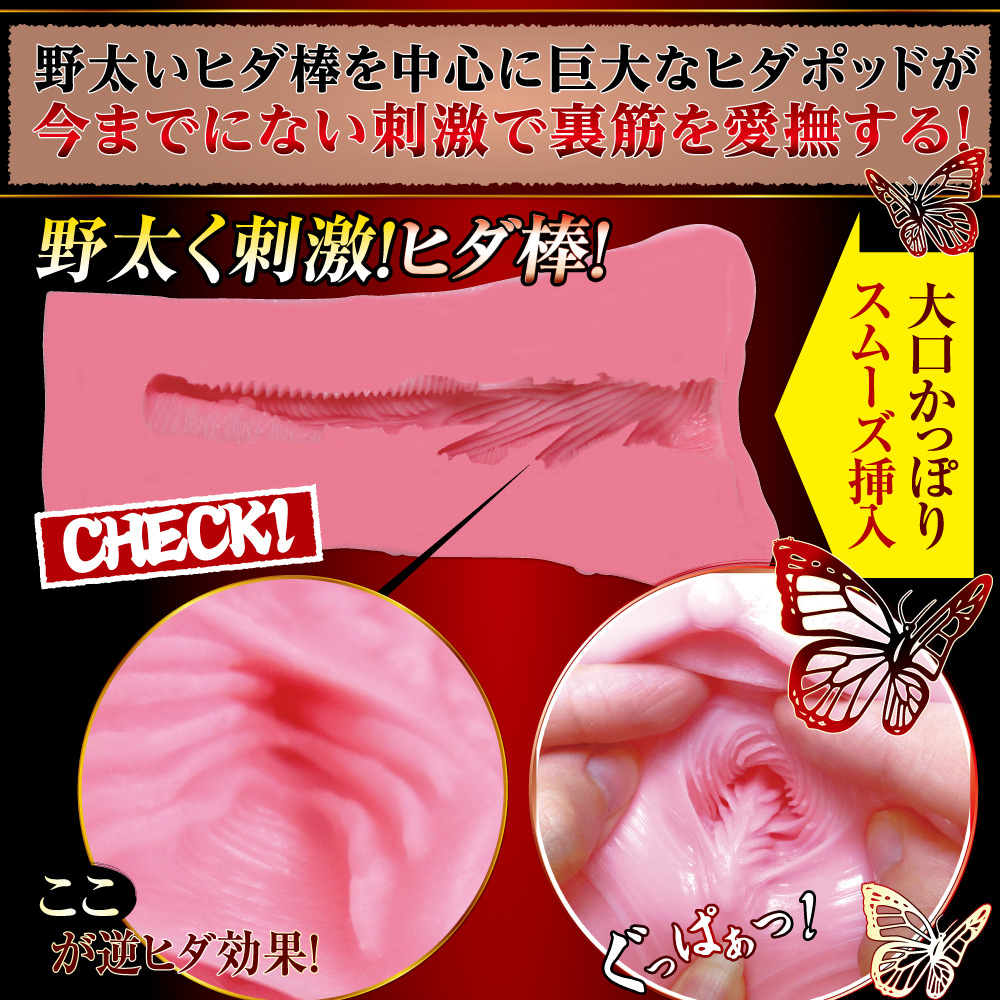 逆ヒダヴァギナージュの内部構造の画像